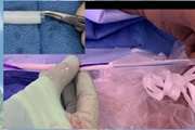 فاز آزمایشگاهی طراحی و تولید عروق آسلولار انسانی، فناوری نوین در جراحی های ترمیمی عروق خلاصه ضرورت اجرای طرح