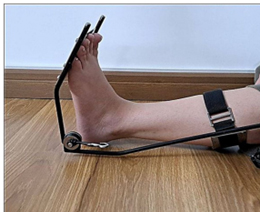 Effect of dry needling plus static stretching on plantar flexor spasticity, function, and quality of life in a patient with chronic stroke: a case report